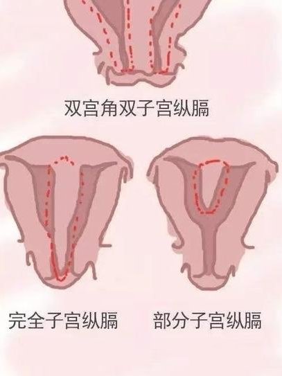 上海试管婴儿医院排行榜是怎样的(上海协和第三代试管婴儿价格多少)